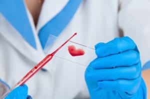 Simple & Affordable Blood Tests Could Save Your Life
