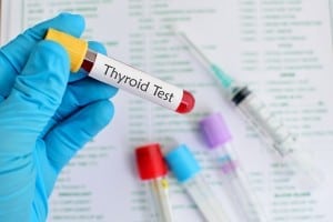 Thyroid Labs