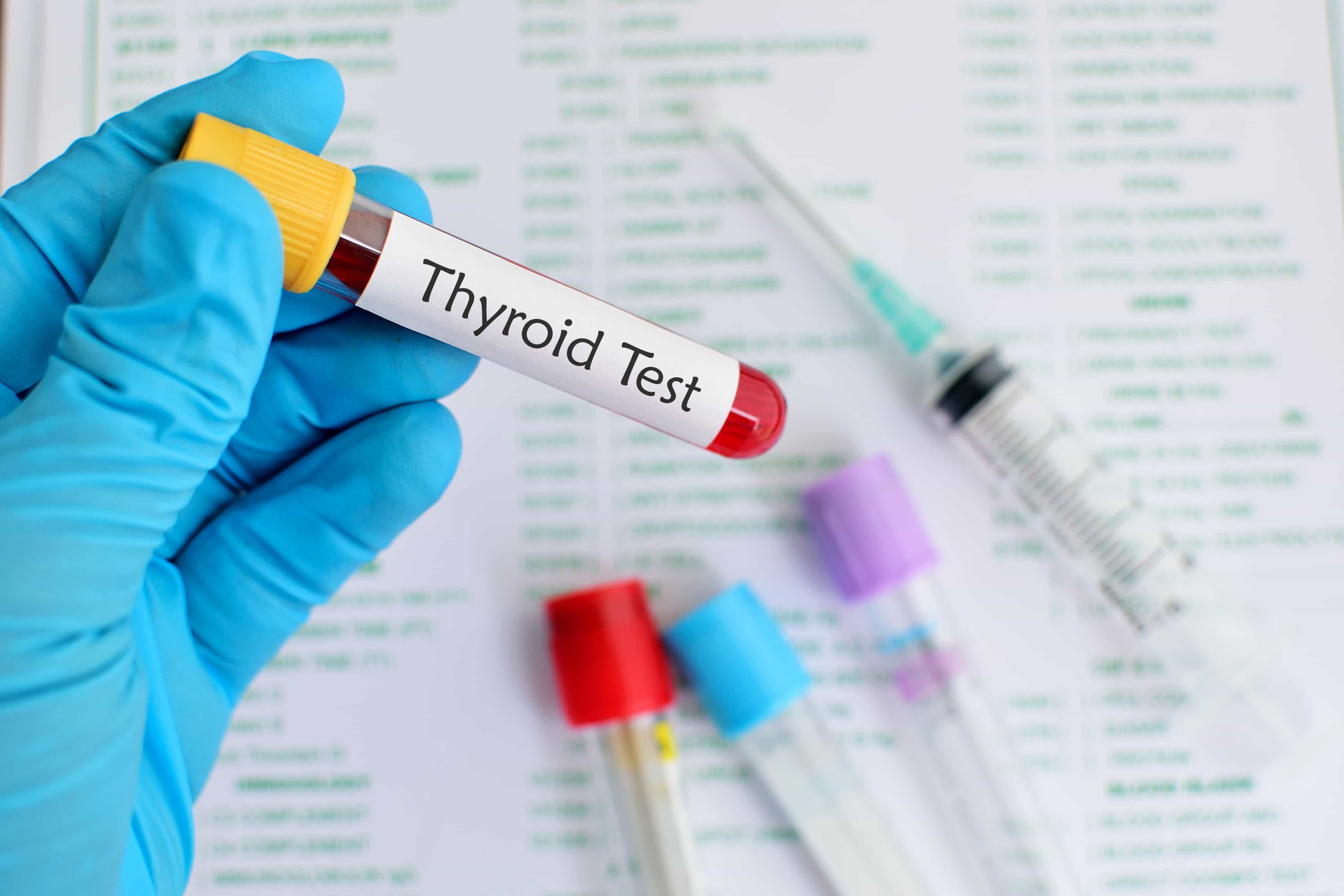 Thyroid Labs