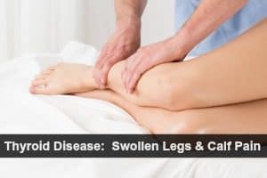 Leg Swelling Calf Pain